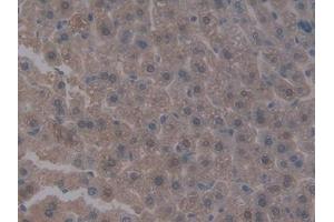 #VALUE! (Integrin beta 5 抗体  (AA 136-378))