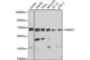 Western blot analysis of extracts of various cell lines, using PRMT5 antibody. (PRMT5 抗体)