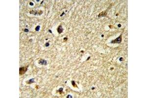 Immunohistochemistry (IHC) image for anti-Cytochrome P450, Family 2, Subfamily E, Polypeptide 1 (CYP2E1) (AA 402-429) antibody (ABIN3030687)