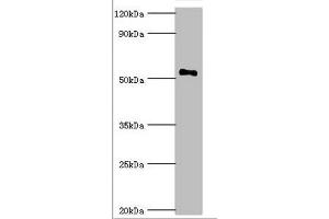 Western blot All lanes: Mothers against decapentaplegic homolog 9 antibody at 2 μg/mL + 293T whole cell lysate Secondary Goat polyclonal to rabbit IgG at 1/10000 dilution Predicted band size: 53, 49 kDa Observed band size: 53 kDa