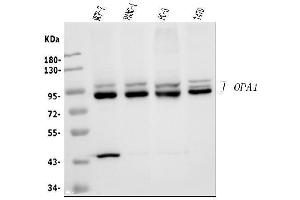Western blot analysis of OPA1 using anti-OPA1 antibody (ABIN3043457).
