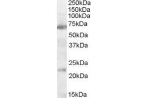 ABIN334375 (0. (CHRNA4 抗体  (AA 29-43))