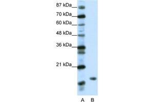 Western Blotting (WB) image for anti-TATA-Binding Protein-Associated Phosphoprotein (DR1) antibody (ABIN2461641) (DR1 抗体)