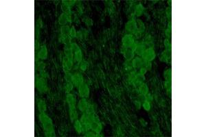 Immunofluorescence (IF) image for anti-Neurotrophic tyrosine Kinase, Receptor, Type 3 (NTRK3) (Extracellular Domain) antibody (ABIN351085)
