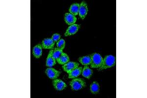 Confocal immunofluorescent analysis of CD46 Antibody (C-term) (ABIN650982 and ABIN2840022) with Hela cell followed by Alexa Fluor® 489-conjugated goat anti-rabbit lgG (green). (CD46 抗体  (C-Term))