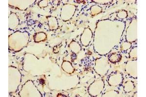 Immunohistochemistry of paraffin-embedded human thyroid tissue using ABIN7146571 at dilution of 1:100 (Calreticulin 抗体  (AA 18-417))