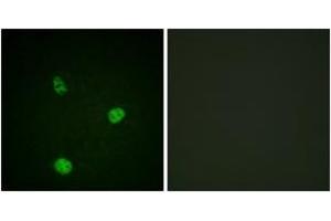 Immunofluorescence (IF) image for anti-Microphthalmia-Associated Transcription Factor (MITF) (AA 151-200) antibody (ABIN2888676) (MITF 抗体  (AA 151-200))