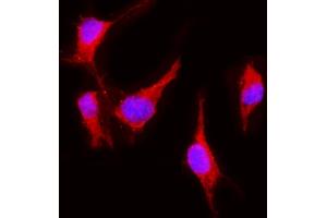 IF analysis of VEGF Receptor 2 using anti-VEGF Receptor 2 antibody (ABIN5693262). (VEGFR2/CD309 抗体  (AA 20-244))