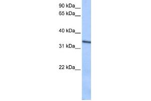 WB Suggested Anti-SEPT9(septin 9) Antibody Titration: 0. (Septin 9 抗体  (C-Term))
