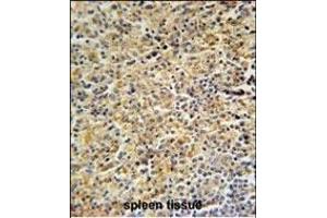 HCK Antibody (N-term) (ABIN652384 and ABIN2841853) immunohistochemistry analysis in formalin fixed and paraffin embedded human spleen tissue followed by peroxidase conjugation of the secondary antibody and DAB staining. (HCK 抗体  (N-Term))