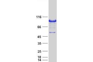 Western Blotting (WB) image for Epsin 1 (EPN1) (Transcript Variant 3) protein (Myc-DYKDDDDK Tag) (ABIN2720345)