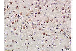 Formalin-fixed and paraffin embedded mouse brain labeled with Anti-SLC4A4 Polyclonal Antibody, Unconjugated (ABIN677498) at 1:400 followed by conjugation to the secondary antibody and DAB staining (kNBC (AA 1-100) 抗体)
