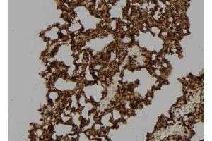 Immunohistochemistry (IHC) image for anti-Ras-Related C3 Botulinum Toxin Substrate 2 (Rho Family, Small GTP Binding Protein Rac2) (RAC2) (C-Term) antibody (ABIN6264603)