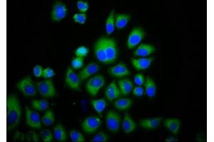 Immunofluorescence staining of Hela cells with ABIN7172863 at 1:133, counter-stained with DAPI. (TRPM3 抗体  (AA 1606-1713))