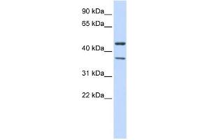 KCNJ4 antibody used at 1 ug/ml to detect target protein. (KCNJ4 抗体  (Middle Region))