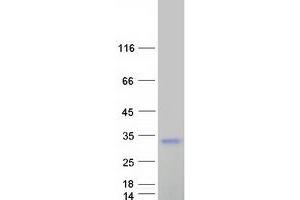 Western Blotting (WB) image for Ring Finger Protein 166 (RNF166) protein (Myc-DYKDDDDK Tag) (ABIN2731038)