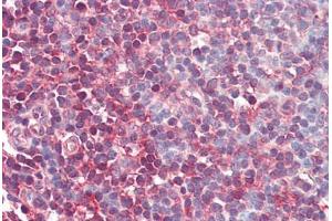 Human Tonsil (formalin-fixed, paraffin-embedded) stained with MAP2K1 antibody ABIN461964 at 10 ug/ml followed by biotinylated goat anti-rabbit IgG secondary antibody ABIN481713, alkaline phosphatase-streptavidin and chromogen. (MEK1 抗体  (N-Term))