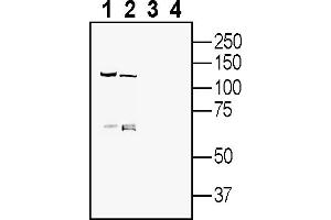 anti-Fibronectin Leucine Rich Transmembrane Protein 3 (FLRT3) (AA 387-401), (Extracellular) antibody