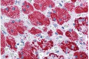 Human Adrenal: Formalin-Fixed, Paraffin-Embedded (FFPE) (ADRP 抗体  (AA 28-281))