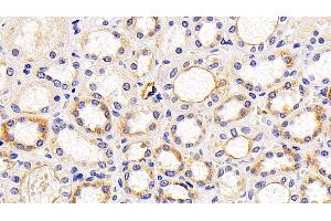 Detection of LAMP1 in Human Kidney Tissue using Polyclonal Antibody to Lysosomal Associated Membrane Protein 1 (LAMP1) (LAMP1 抗体  (AA 49-297))