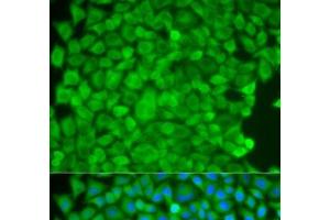 Immunofluorescence analysis of HeLa cells using SGCE Polyclonal Antibody (SGCE 抗体)
