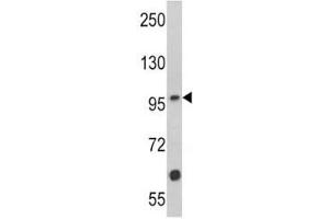 Western blot analysis of MUSK antibody and Jurkat lysate