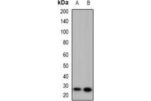 Western blot analysis of 42431 expression in HeLa (A), PC12 (B) whole cell lysates. (MARCH2 抗体  (C-Term))