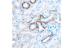 Immunohistochemistry of paraffin-embedded Mouse kidney using C Rabbit pAb (ABIN7266006) at dilution of 1:50 (40x lens). (CABP1 抗体)