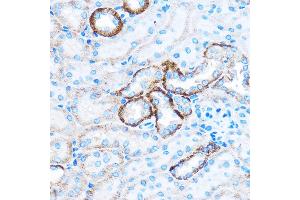 Immunohistochemistry of paraffin-embedded Mouse kidney using C Rabbit pAb (ABIN7266006) at dilution of 1:50 (40x lens).