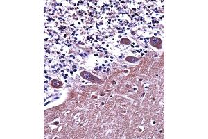 Immunohistochemistry (Paraffin-embedded Sections) (IHC (p)) image for anti-Adaptor-Related Protein Complex 2, alpha 1 Subunit (AP2A1) (AA 706-735), (C-Term) antibody (ABIN657826)