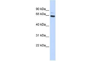 WB Suggested Anti-ZNF74 Antibody Titration:  0. (ZNF74 抗体  (Middle Region))