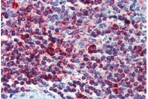 Human Spleen (formalin-fixed, paraffin-embedded) stained with HSPD1 antibody ABIN462364 followed by biotinylated anti-mouse IgG secondary antibody ABIN481714, alkaline phosphatase-streptavidin and chromogen. (HSPD1 抗体)