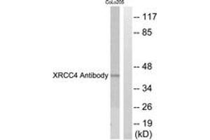 Western blot analysis of extracts from COLO205 cells, using XRCC4 Antibody. (DIRC2 抗体  (AA 261-310))