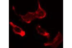 ABIN6274690 staining HuvEc cells by IF/ICC. (Laminin gamma 1 抗体  (N-Term))