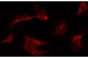ABIN6266453 staining Hela by IF/ICC. (MAPK15 抗体  (pThr175, pTyr177))