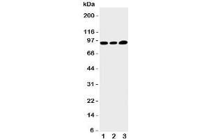 Western blot testing of TRPV3 antibody and Lane 1:  HeLa;  2: A549;  3: MCF-7 cell lysate.