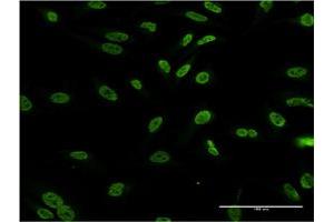 Immunofluorescence of monoclonal antibody to DLX1 on HeLa cell. (DLX1 抗体  (AA 152-255))
