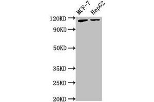 Western Blot Positive WB detected in: MCF-7 whole cell lysate, HepG2 whole cell lysate All lanes: ATP9A antibody at 3. (ATP9A 抗体  (AA 2-69))