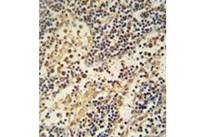Immunohistochemistry analysis in formalin fixed and paraffin embedded human lymph node reacted with HEMK1 Antibody (C-term) followed  which was peroxidase-conjugated to the secondary antibody, followed by DAB staining. (HEMK1 抗体  (C-Term))