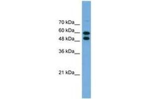 Image no. 1 for anti-Phosphoglucomutase 1 (PGM1) (AA 467-516) antibody (ABIN6746448) (Phosphoglucomutase 1 抗体  (AA 467-516))