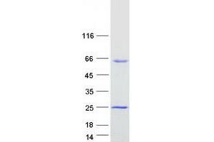 Western Blotting (WB) image for Angio-Associated, Migratory Cell Protein (AAMP) protein (Myc-DYKDDDDK Tag) (ABIN2714252)