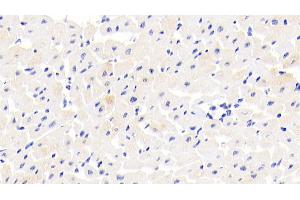 Detection of COL14 in Human Cardiac Muscle Tissue using Polyclonal Antibody to Collagen Type XIV (COL14) (COL14A1 抗体  (AA 1280-1461))