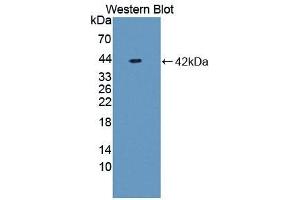 Detection of Recombinant NFkB, Rat using Polyclonal Antibody to Nuclear Factor Kappa B (NFkB) (NFkB 抗体  (AA 352-439))