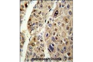 Immunohistochemistry (Paraffin-embedded Sections) (IHC (p)) image for anti-Serpin Family C Member 1 (SERPINC1) (AA 364-393), (C-Term) antibody (ABIN390671)