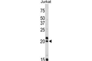 Western Blotting (WB) image for anti-Vasoactive Intestinal Peptide (Vip) antibody (ABIN3002683) (Vip 抗体)