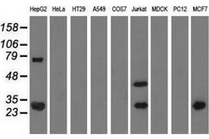 Western blot analysis of extracts (35 µg) from 9 different cell lines by using anti-QPRT monoclonal antibody. (QPRT 抗体)