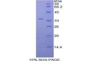 SDS-PAGE analysis of Human Myosin IF Protein. (MYO1F 蛋白)