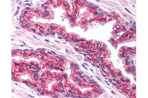Anti-FOXA1 antibody IHC of human prostate. (FOXA1 抗体  (AA 395-444))