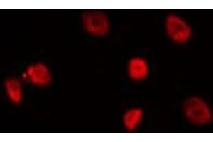 ABIN6275128 staining Hela by IF/ICC. (FOXD4 抗体  (Internal Region))