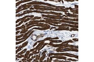 Immunohistochemical staining of human heart muscle with KCNH7 polyclonal antibody  shows strong cytoplasmic positivity in myocytes at 1:1000-1:2500 dilution. (KCNH7 抗体)